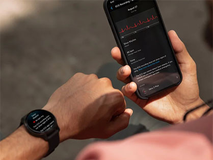 Garmin ECG alkalmazás Európában és Ausztráliában